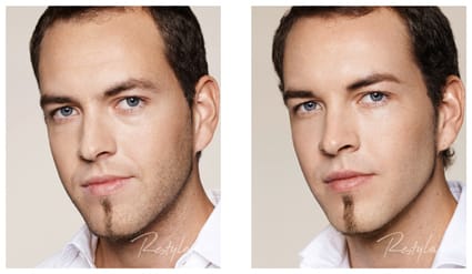 injectables male