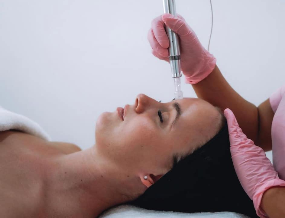 exceed skin needling device exceed skin needling device